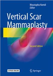 Cover Vertical Scar Mammaplasty