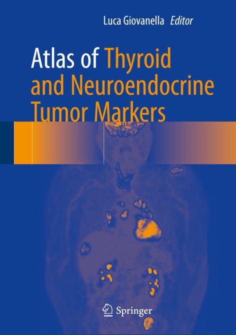 Thyroid and Neuroendocrine Tumors Markers (Atlas)