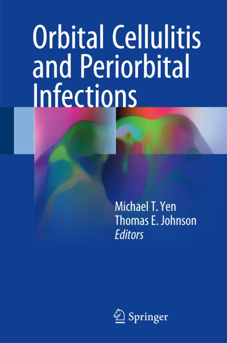 Orbital Cellulitis and Periorbital Infections