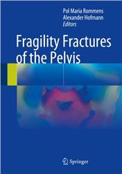 Cover Fragility Fractures of the Pelvis