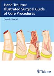 Cover Hand Trauma: Illustrated Surgical Guide of Core Procedures