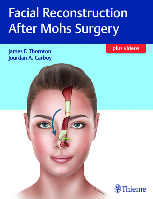 Facial Reconstruction after Mohs Surgery