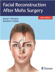 Cover Facial Reconstruction after Mohs Surgery