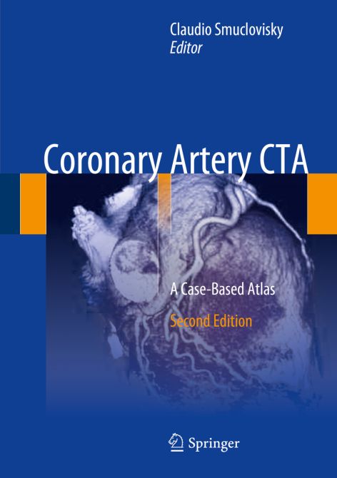 Coronary Artery CTA