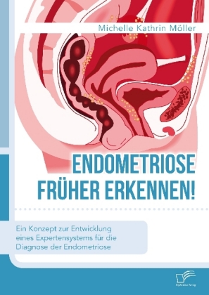 Endometriose früher erkennen!