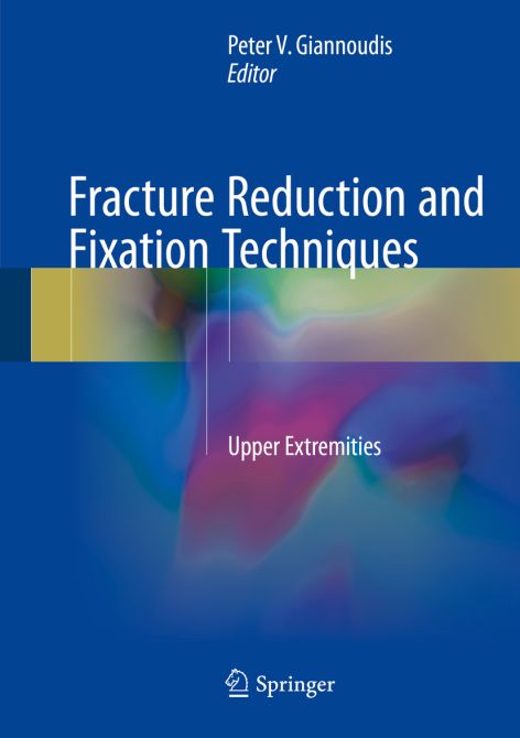 Osteosynthesis of Fractures