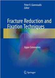 Cover Osteosynthesis of Fractures