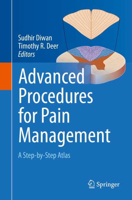 Advanced Procedures for Pain Management