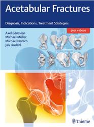 Cover Acetabular Fractures