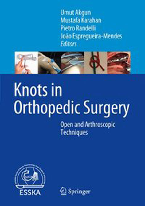 Knots in Orthopedic Surgery