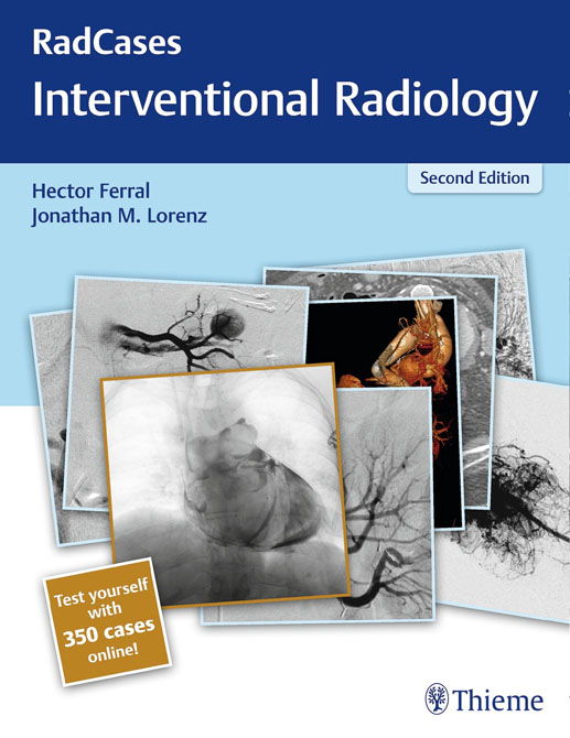 Radcases Interventional Radiology