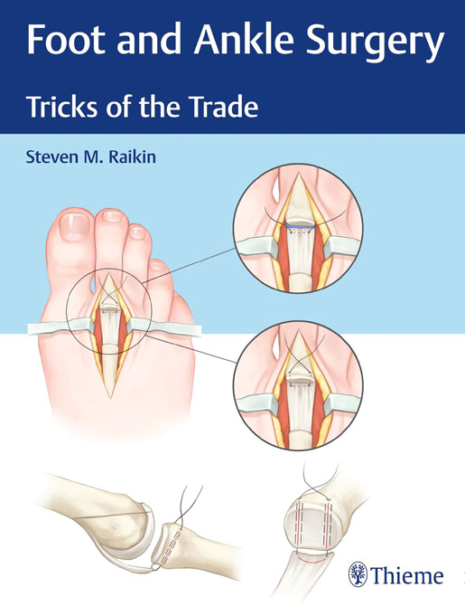 Foot and Ankle Surgery