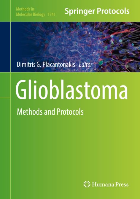 Glioblastoma