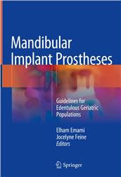 Cover Mandibular Implant Prosthesis