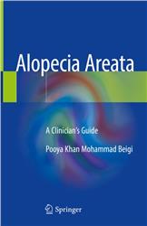 Cover Alopecia Areata