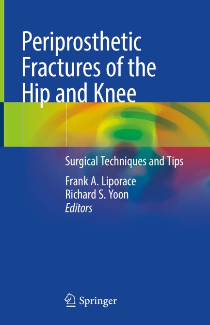 Periprosthetic Fractures of the Hip and Knee