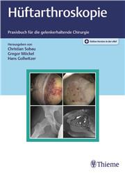 Cover Hüftarthroskopie