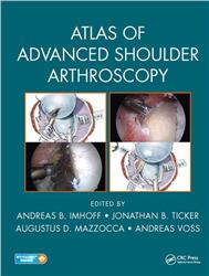 Cover Atlas of Advanced Shoulder Arthroscopy