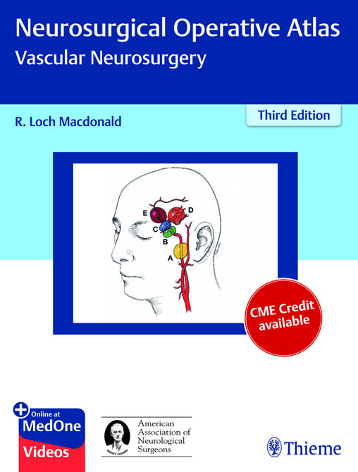 Neurosurgical Operative Atlas: Vascular Neurosurgery