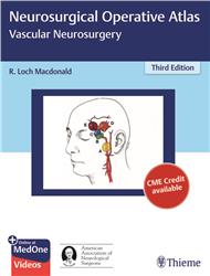 Cover Neurosurgical Operative Atlas: Vascular Neurosurgery