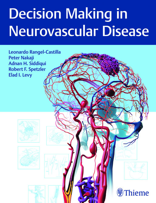 Decision Making in Neurovascular Disease