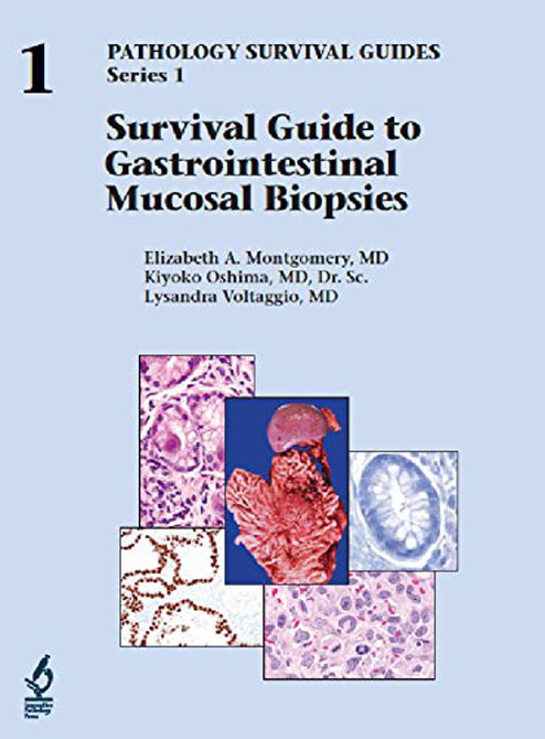 Survival Guide to Gastrointestinal Mucosal Biopsies