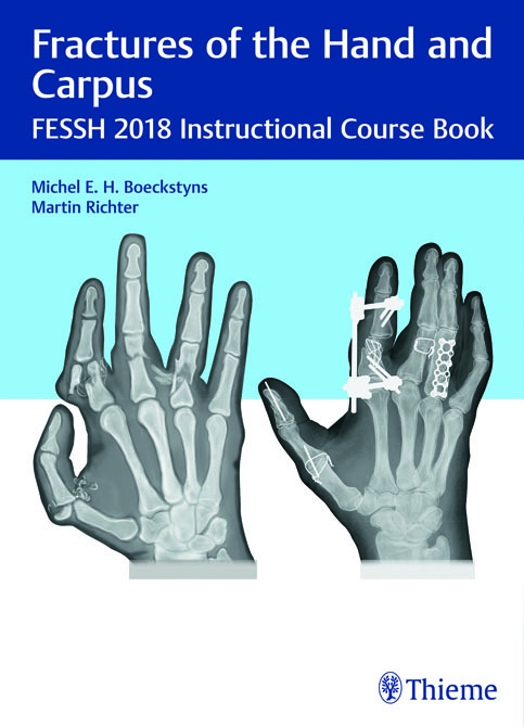 Fractures of the Hand and Carpus