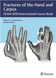 Cover Fractures of the Hand and Carpus