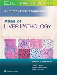 Cover Atlas of the Liver Pathology: A Pattern Based Approach