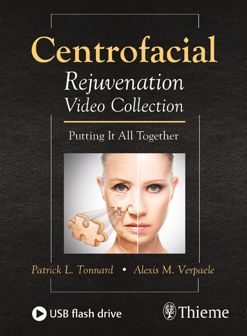 Centrofacial Rejuvenation Video Collection. DVD