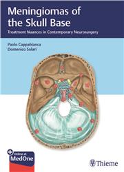 Cover Meningiomas of the Skull Base