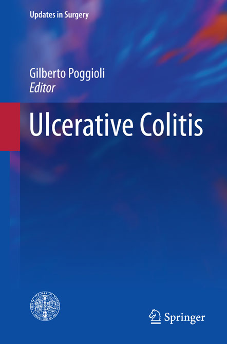 Management and Treatment of Ulcerative Colitis