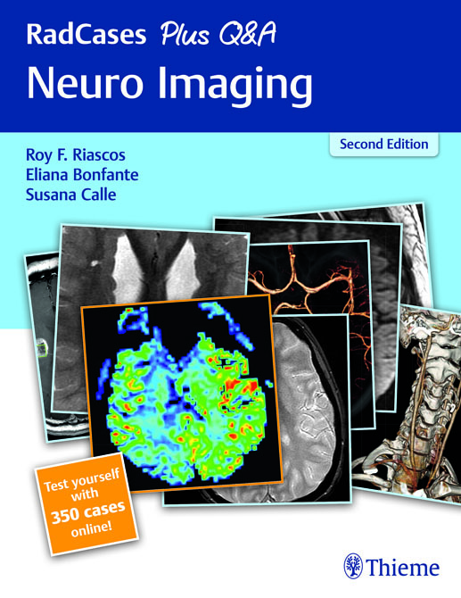 Radcases Neuro Imaging