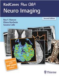 Cover Radcases Neuro Imaging