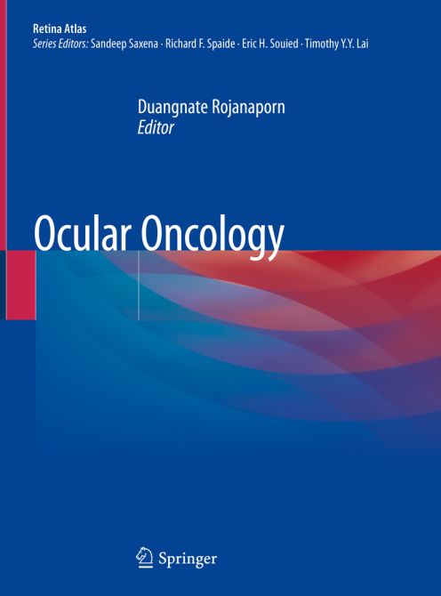 Ocular Oncology