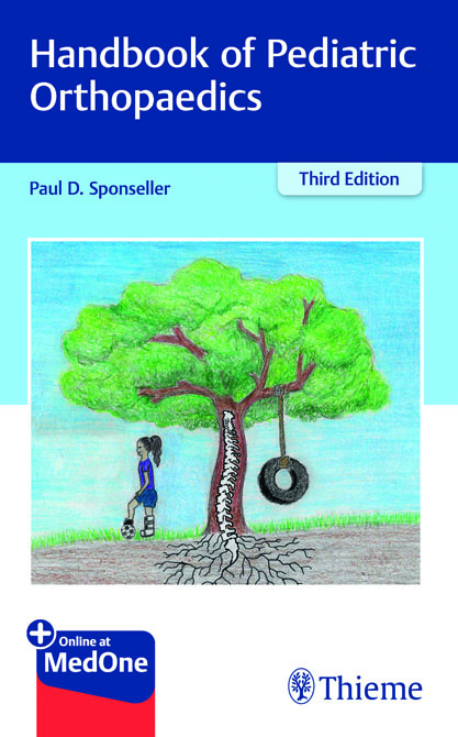 Handbook of Pediatric Orthopaedics