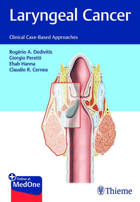 Laryngeal Cancer