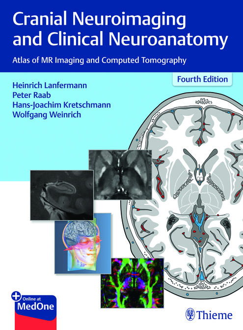 Cranial Neuroimaging and Clinical Neuroanatomy