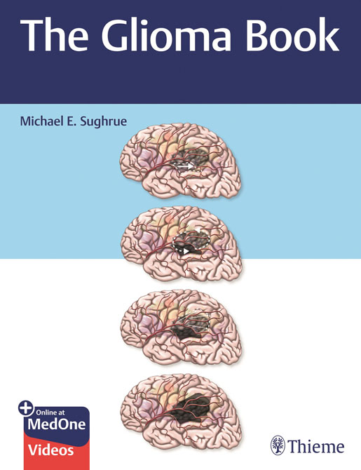 The Glioma Book