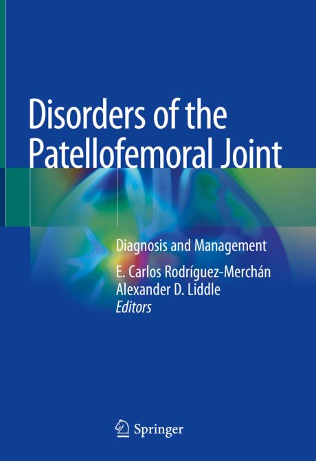 Disorders of the Patellofemoral Joint