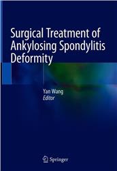 Cover Surgical Treatment of Ankylosing Spondylitis Deformity