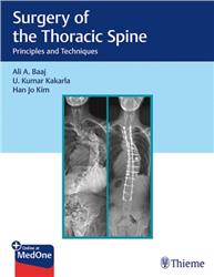 Cover Surgery of the Thoracic Spine: Principles and Techniques