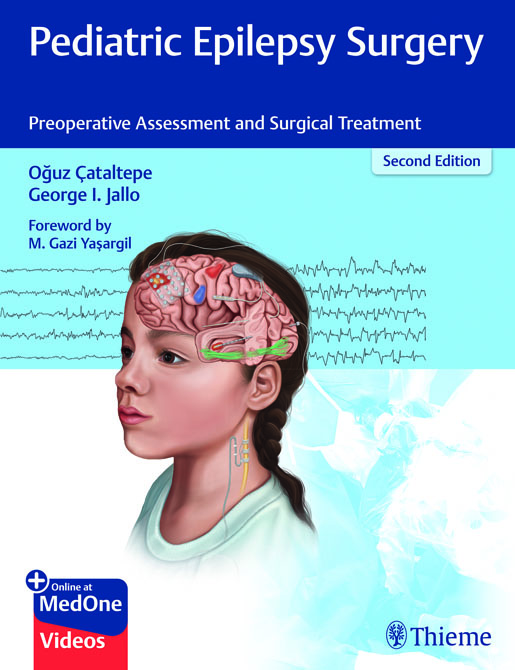 Pediatric Epilepsy Surgery