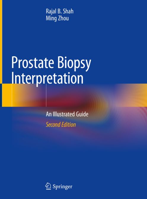 Prostate Biopsy Interpretation