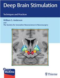 Cover Deep Brain Stimulation