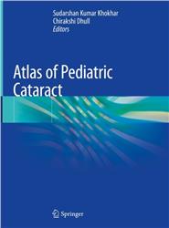 Cover Atlas of Pediatric Cataract