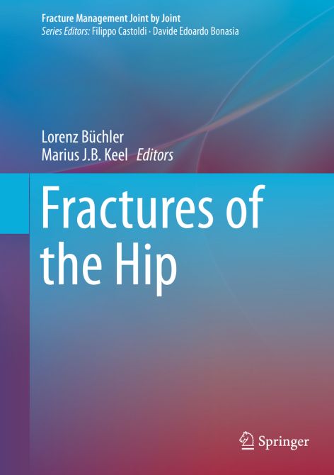 Fractures of the Hip