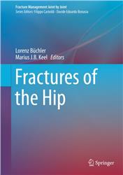 Cover Fractures of the Hip