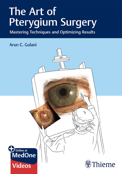 The Art of Pterygium Surgery: Mastering Techniques and Optimizing Results