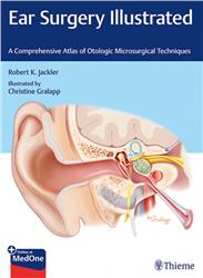 Cover Ear Surgery Illustrated: A Comprehensive Atlas of Otologic Microsurgical Techniques